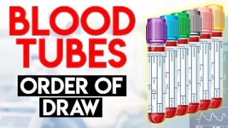 2025 Global Trends and Strategies for Red Top Tube Blood Test Solutions