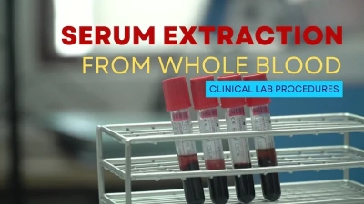 What Makes Lavender Blood Tubes Essential for Modern Laboratories