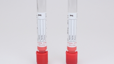 Red Tube