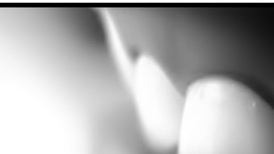 Ultimate Checklist for Choosing the Best Dental Implant System for Your Practice