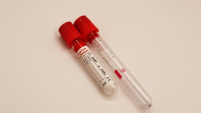Serum Tubes