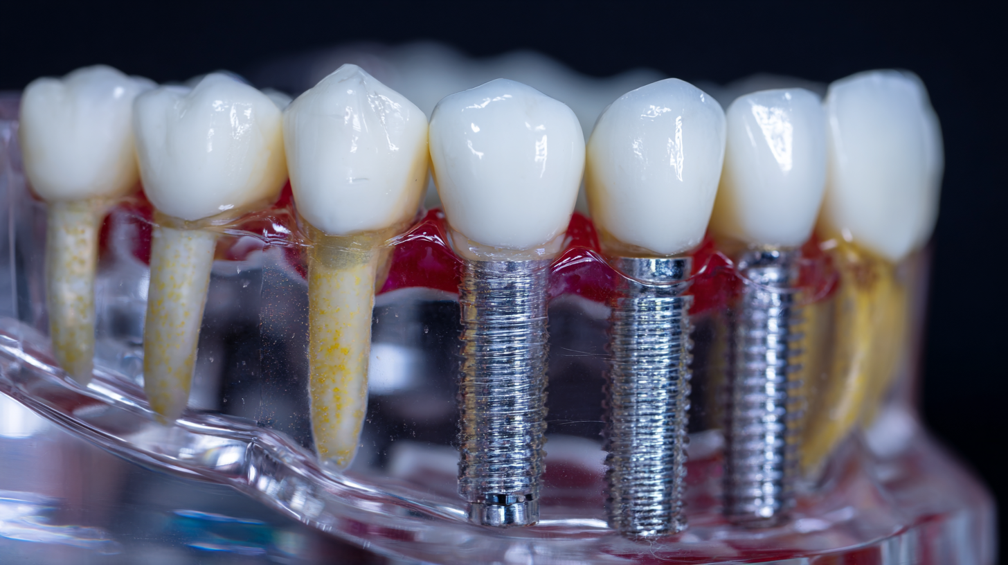 Top Strategies for Selecting the Best Titanium Implants for Your Needs