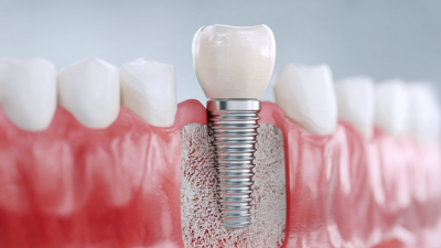 How to Choose the Right Best Zirconia Dental Implants for Your Oral Health Needs