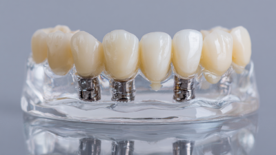 5 Essential Tips for Choosing the Right Abutment Dental Solutions for Your Practice