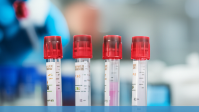 How to Choose the Right Blood Container Tube for Your Laboratory Needs