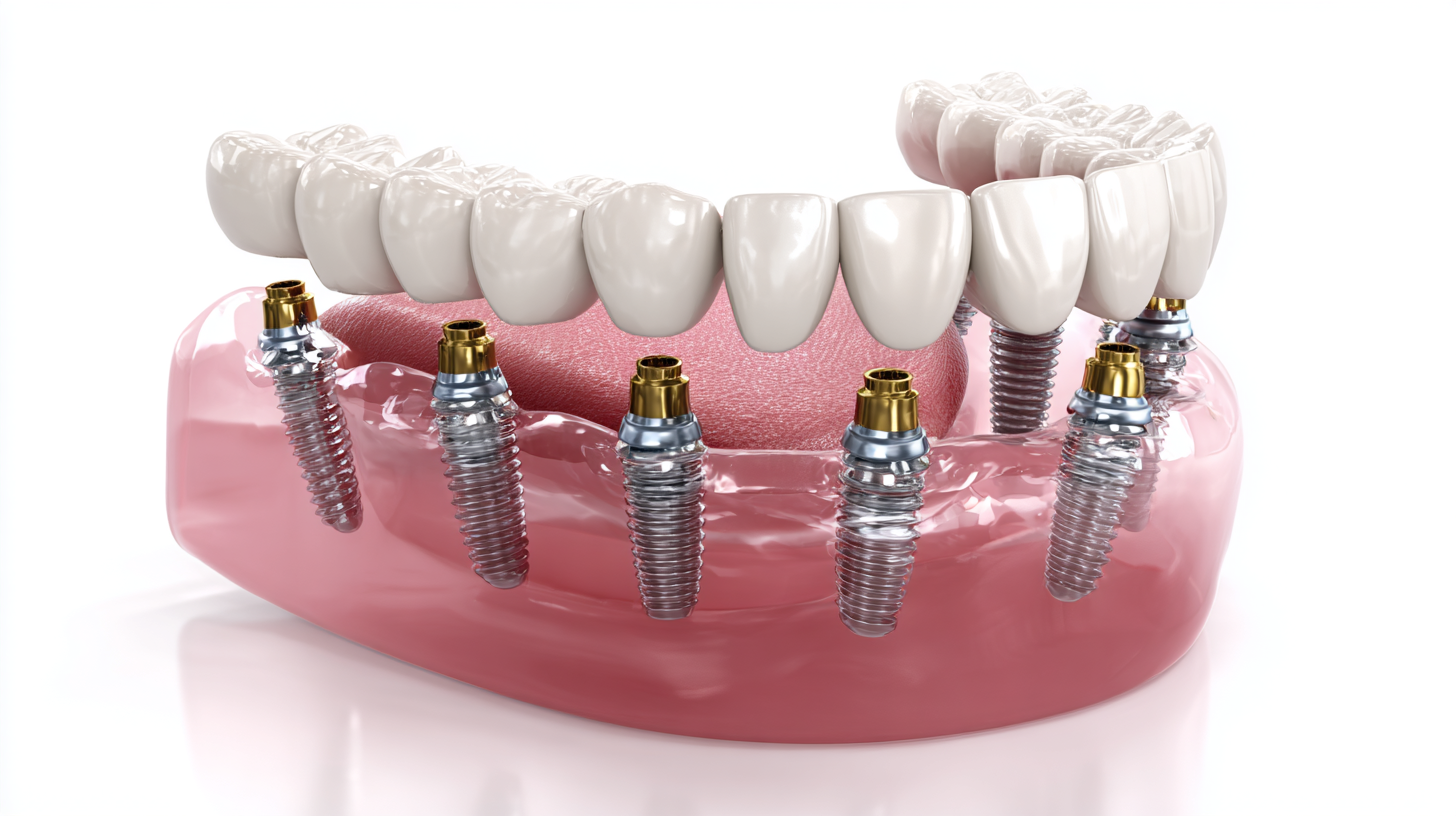 Mastering Denture Implant Abutments A Comprehensive Guide for Global Buyers