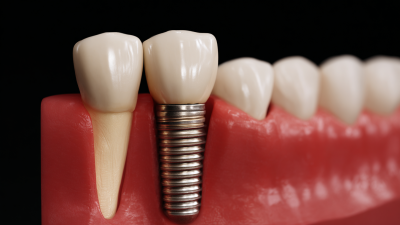 How to Choose the Right Dental Implant for Your Needs