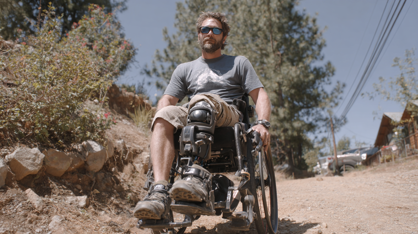 How to Choose the Right Universal Prosthetic Kit for Optimal Mobility and Comfort