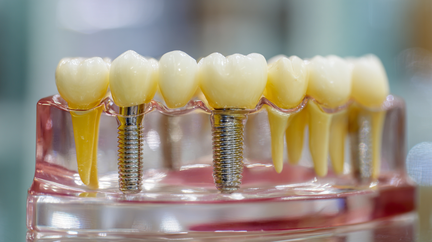 The Ultimate Guide to Selecting the Perfect Denture Abutment for Your Patients