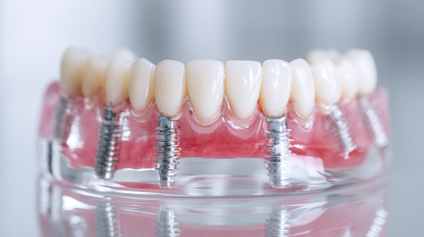The Ultimate Guide to Choosing the Right Denture Implants for Your Smile