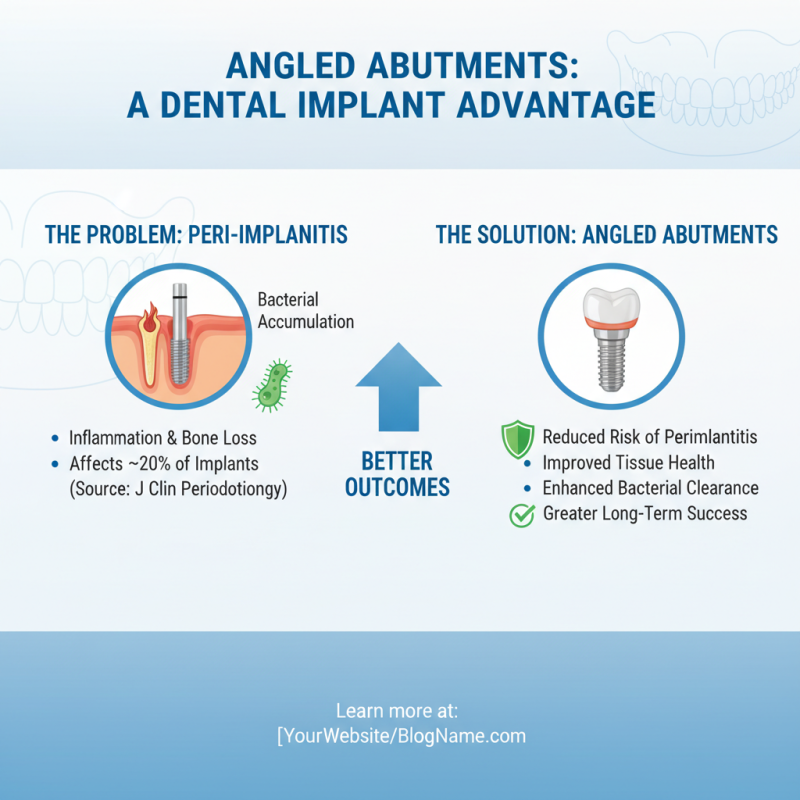 Top Benefits of Using Angled Abutments in Dental Implants for Optimal Results