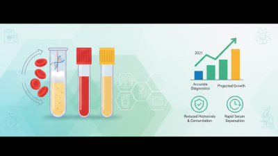 The Ultimate Guide to Gel and Clot Activator Tube Uses and Benefits