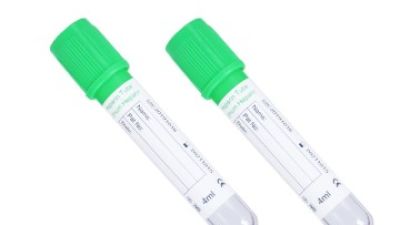 green top sodium heparin tube