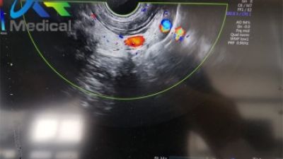 Why Choose the Best Philips Ultrasound Transducers Repair Services?