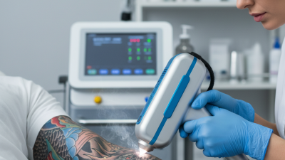 Best Laser Machine for Tattoo Removal What to Consider?