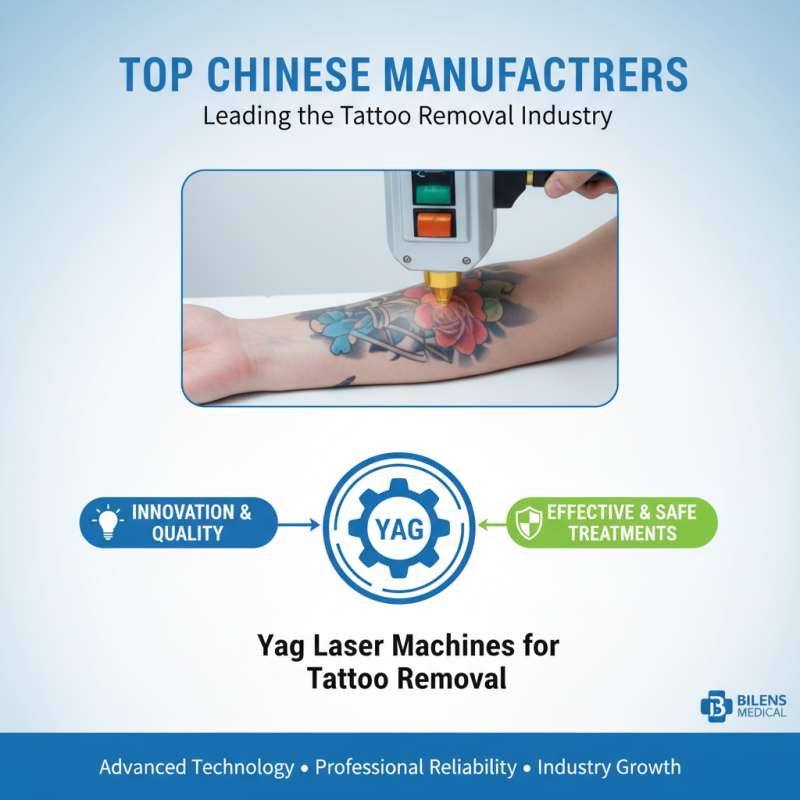 Why Choose the Best Tattoo Removal Machines Manufacturers in China?