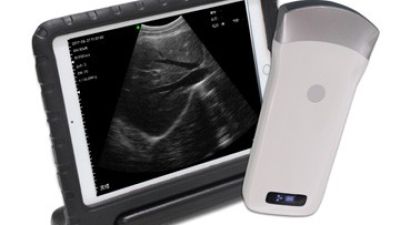 CW-3C convex palm B_W ultrasound 01.jpg