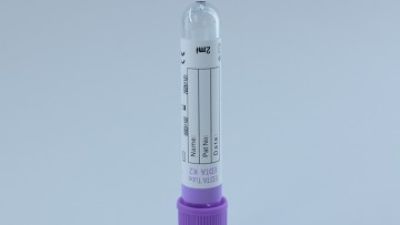2ml Glass EDTA Tube