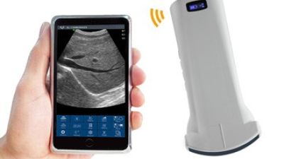 CW-6C convex palm doppler ultrasound 01.jpg
