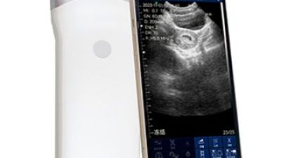 ECI-V80S Veterinary Wireless Ultrasound Scanner 1.jpg