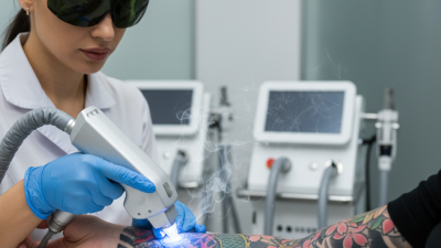 Wie lassen sich Pico-Laser-Nd-YAG-Tattoos effektiv entfernen (Stand: 2026)?