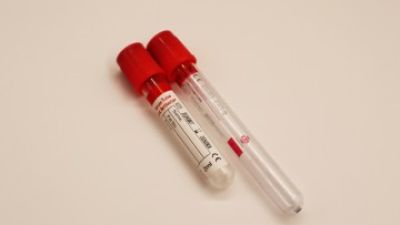 Serum Tubes