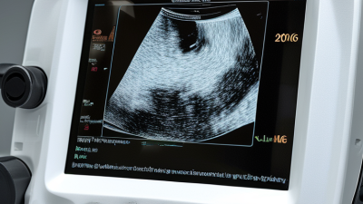 2026 Best Linear Transducer Ultrasound for Global Buyers?