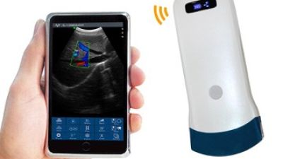 CW-5C convex palm doppler ultrasound 01.jpg