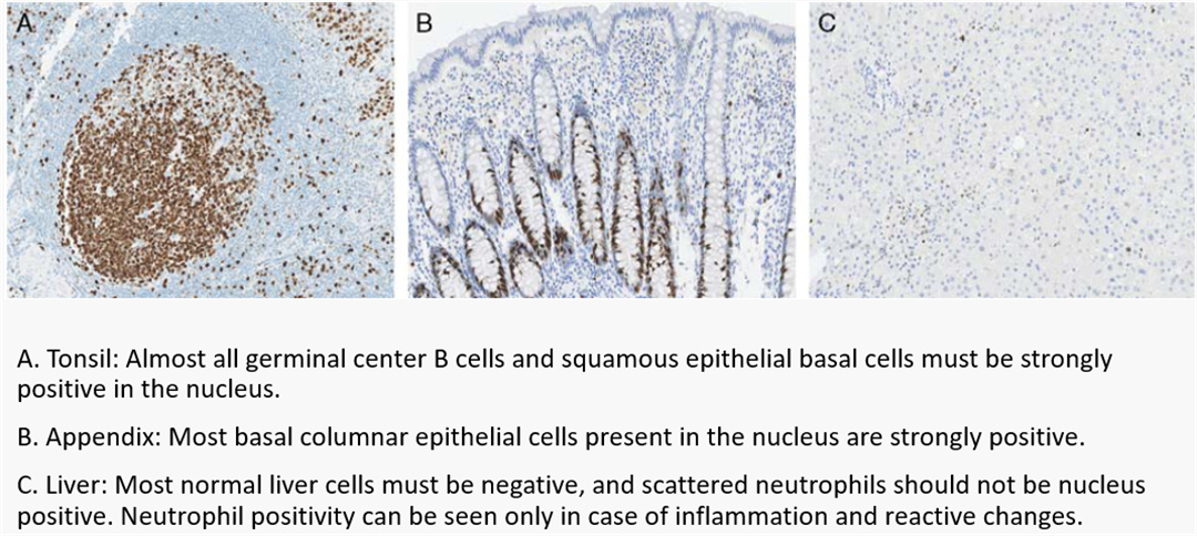 Stosowanie chipów tkankowych do badań immunohistochemicznych i specjalnej kontroli jakości barwienia (1)8d2