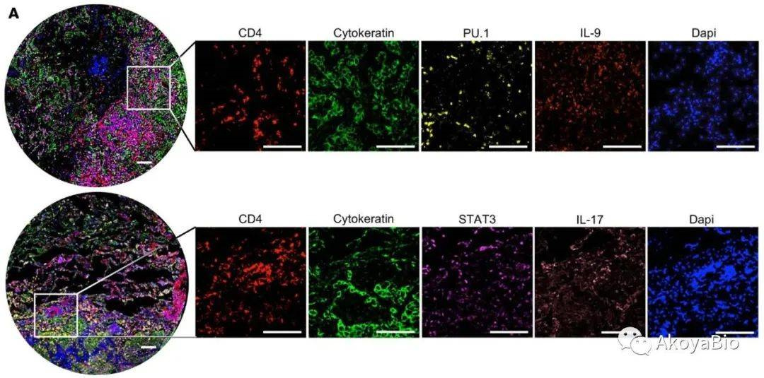 Uso de chips de tejido para inmunohistoquímica y control de calidad de tinciones especiales (3)k0w