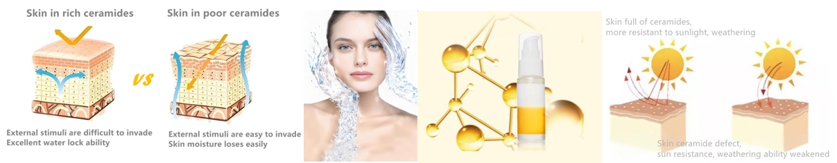 ceramide ceramide ap eop skin barrier