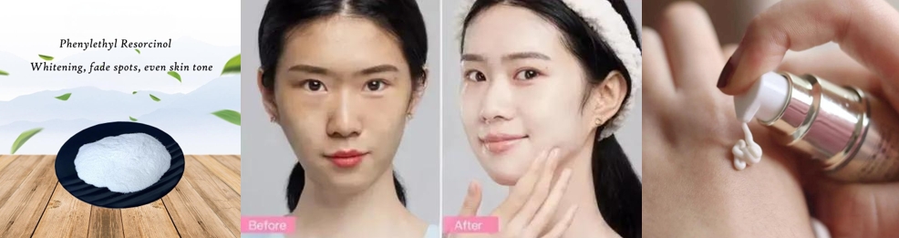 Feniletil Resorinol cilt aydınlatma
