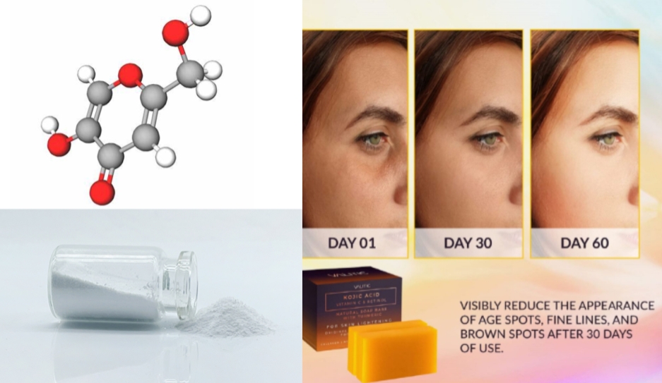kojic acid222.png