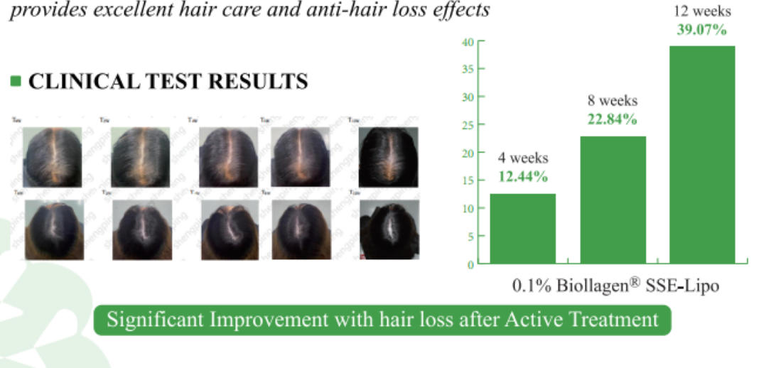 콘텐츠 일러스트레이션 - 재조합형 III형 콜라겐 액상 원료(SSE-Lipo)-2
