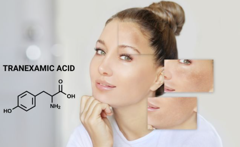 内容插图-tranexamic acid 2