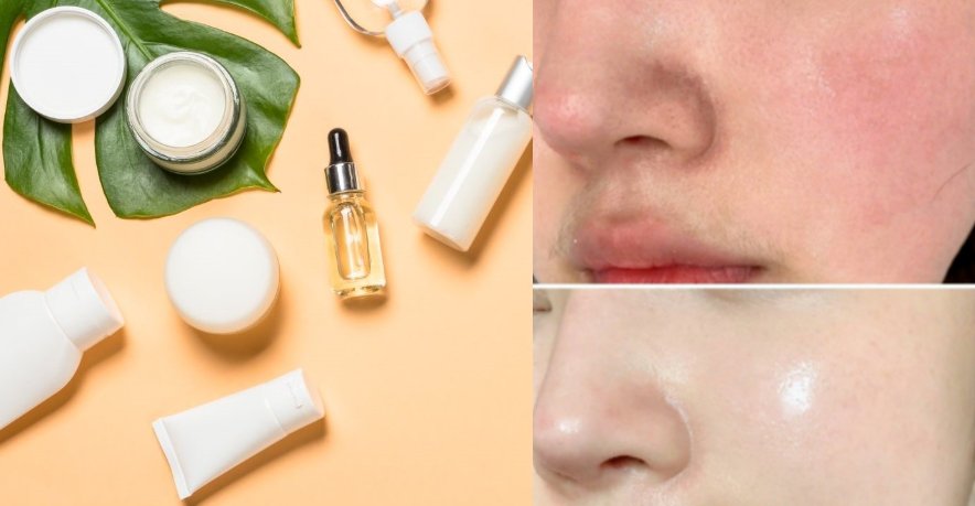 ascorbyl tetraisopalmitate skin lighting.png