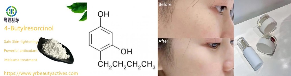 4-butilresorcinol-1.jpg