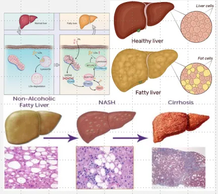 Experiencing dull skin and fatigue? It's time to pay attention, as your liver may be compromised!
