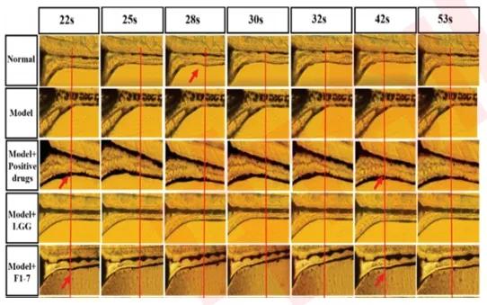 Two intestinal peristaltic peaks appeared within 1 min in the animal experiment.jpg