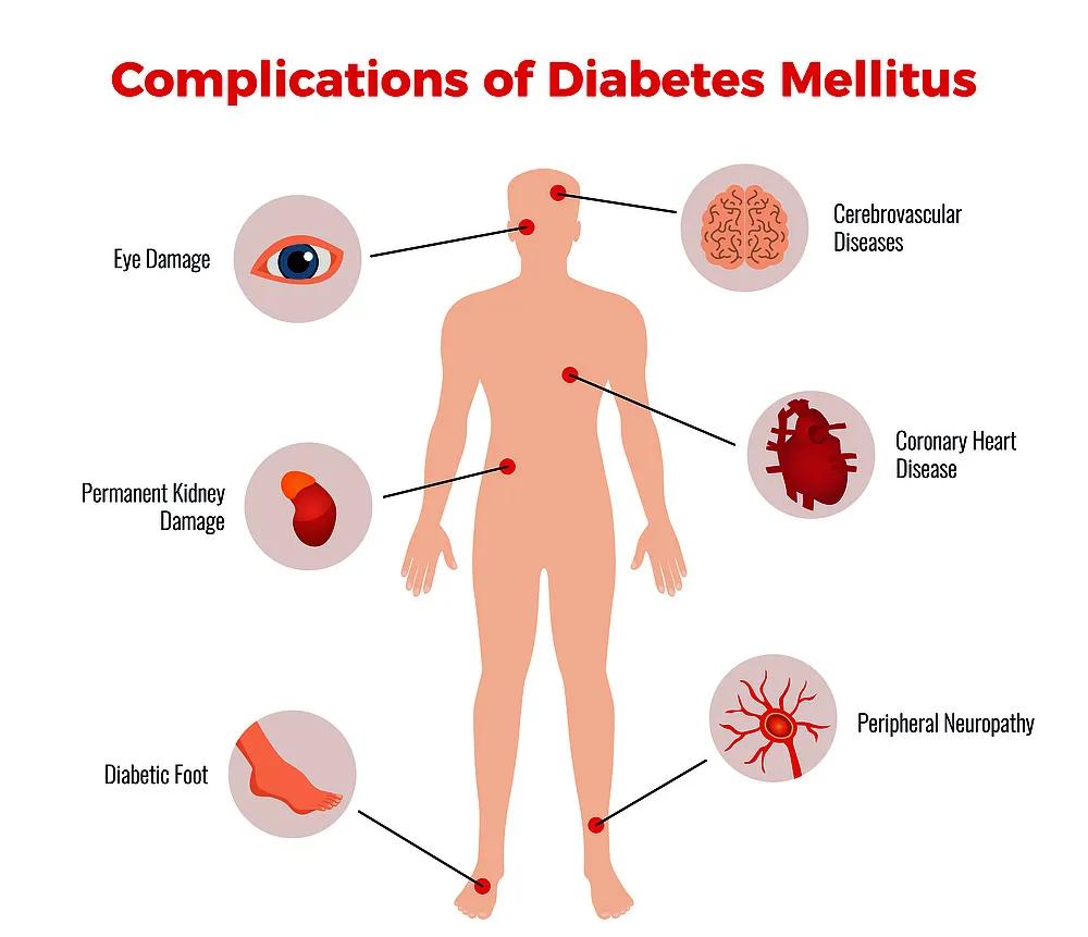 The Crucial Role of Probiotics in the Prevention and Management of Diabetes, Part 1