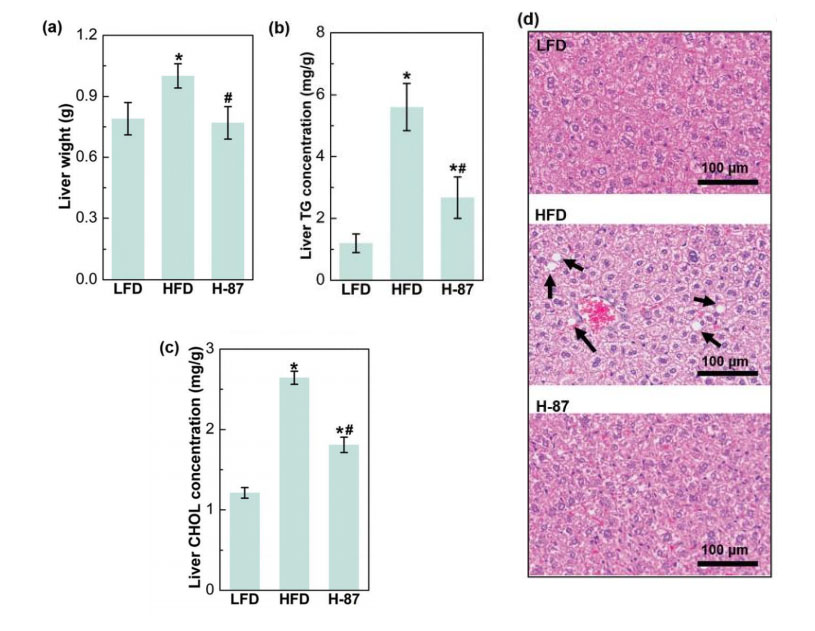 H-87 reduces liver lipogenesis
