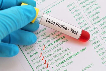 Lipid Management/ZC-SLM/Probiotics Premix/500B