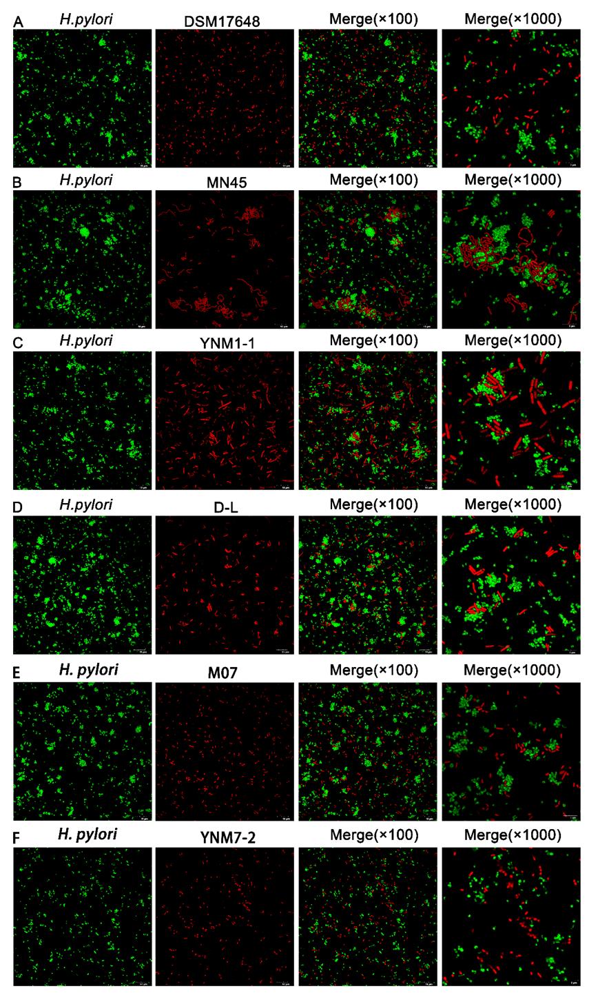 Latest Research: Postbiotics Inhibit Helicobacter pylori, Helping White-Collar Workers Combat the "Invisible Overtime" Monster in Their Stomachs! Part 1