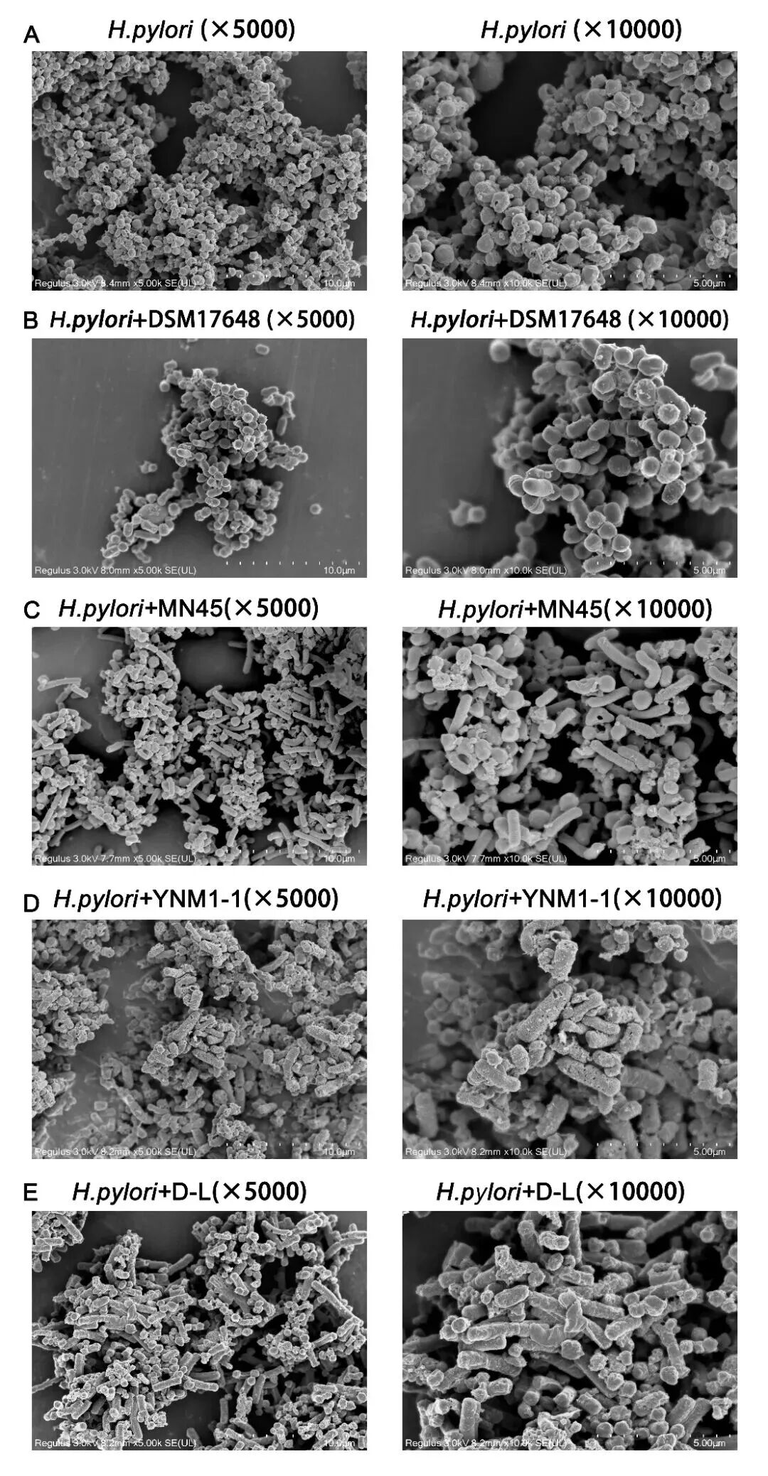 Latest Research: Postbiotics Inhibit Helicobacter pylori, Helping White-Collar Workers Combat the "Invisible Overtime" Monster in Their Stomachs! Part 2