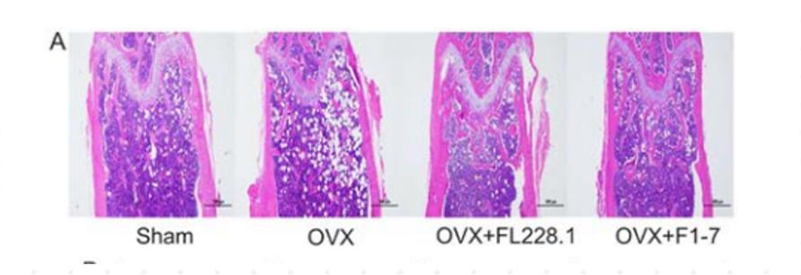 What can elderly people with osteoporosis and prone to fractures do? This strain of bacteria is here to help!