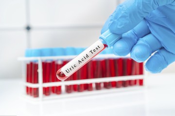 Lower Uric Acid Levels By Opening, The Uric Acid Excretion Valve/Probiotics Premix