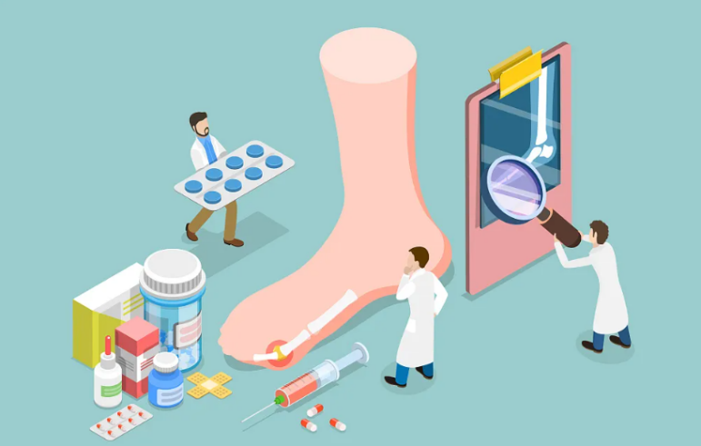 Prevention and Control of Gout