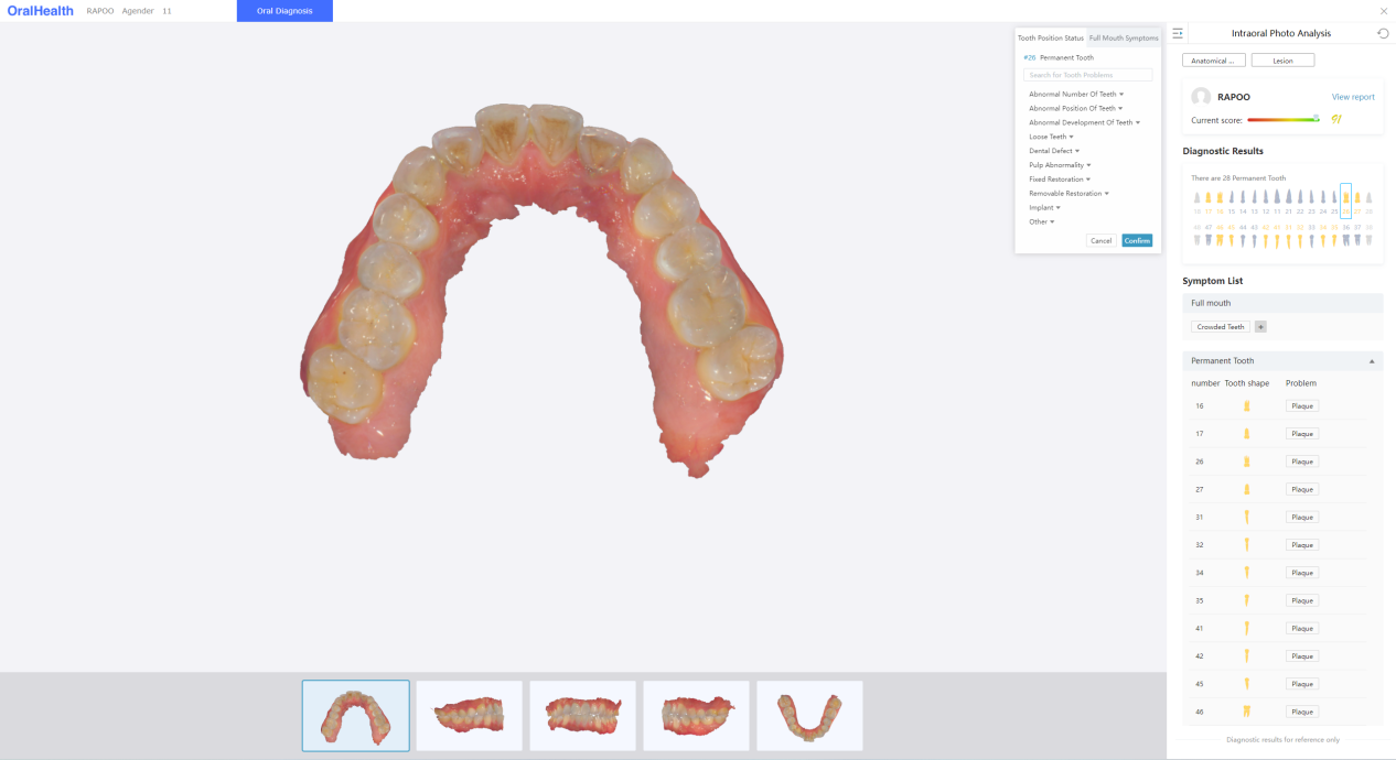 Mise à jour du logiciel Oral Scanner : Lancement officiel de la nouvelle fonction d’analyse de la santé bucco-dentaire