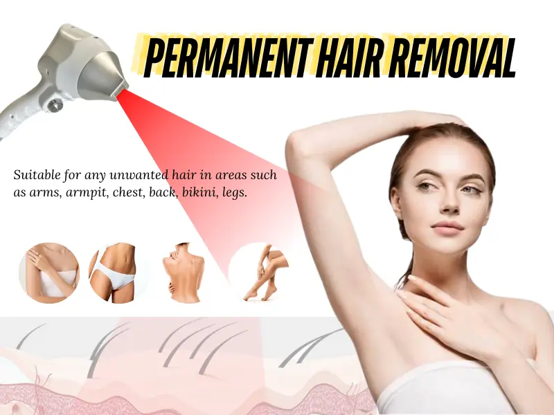 Clinical Applications of Different Wavelengths of Hair Removal Lasers