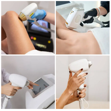 Aesthetic Laser Market Continues to Expand: From Clinics to Homes, Semiconductor Lasers Are Becoming the Mainstream Choice